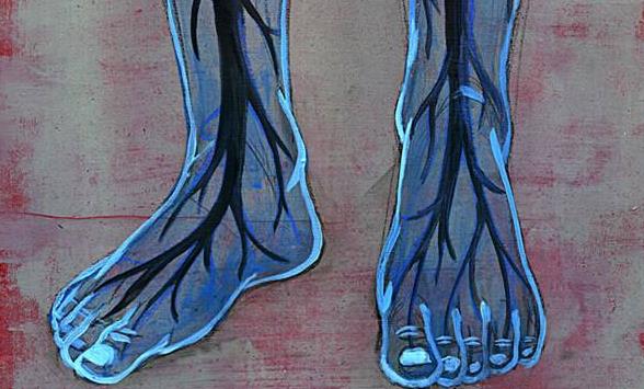 糖尿病不可怕并发症可怕视频,糖尿病综合症和糖尿病并发症