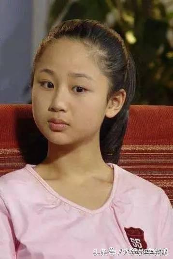 杨紫的法令纹能消除吗,杨紫法令纹很深怎么回事