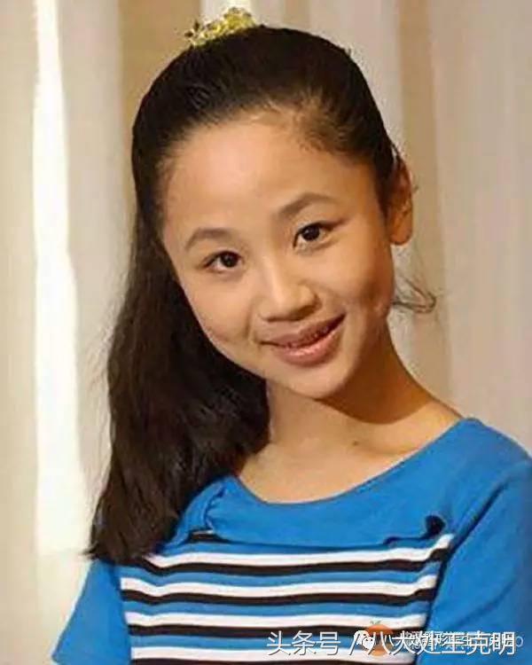 杨紫的法令纹能消除吗,杨紫法令纹很深怎么回事