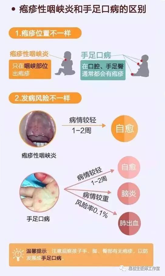 亮剑“疱疹性咽峡炎”,中医中药显良效!