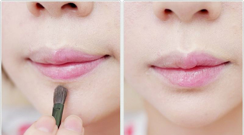 很多人嘴唇上有一道疤,为什么上嘴唇会多出一点肉