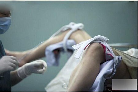 意外怀孕打胎后后悔快要疯了,意外怀孕打胎多少费用