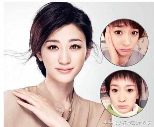 整完容真的美吗？明星整容前后对比图，没对比没伤害！