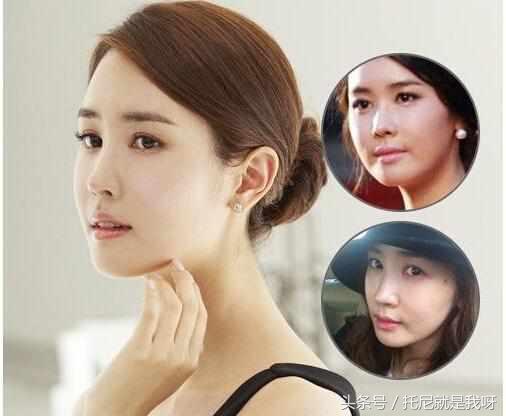 整完容真的美吗？明星整容前后对比图，没对比没伤害！