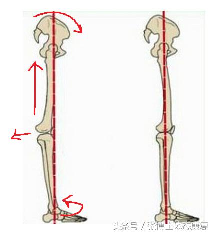 体态矫正训练腿型,体态调理腿成M式练习