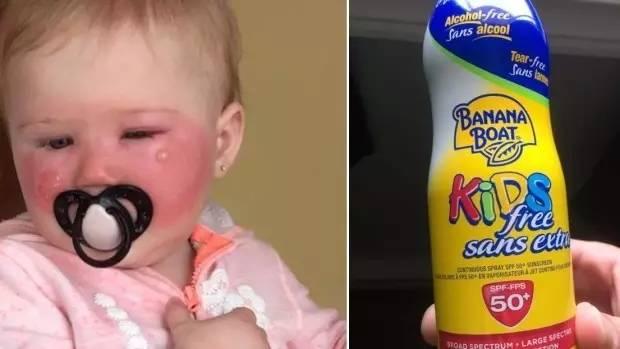 夏季宝宝防晒需谨慎,妈妈们要科学防晒