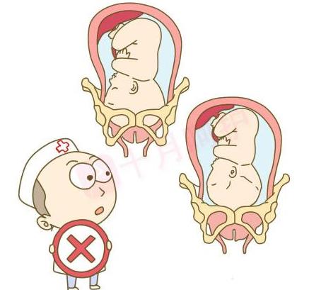 孕妈们注意这些姿势易胎位不正,孕妈臀位