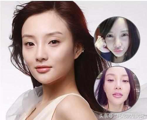 整完容真的美吗？明星整容前后对比图，没对比没伤害！
