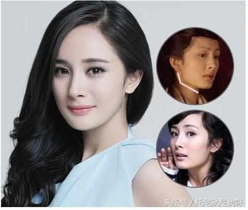 整完容真的美吗？明星整容前后对比图，没对比没伤害！