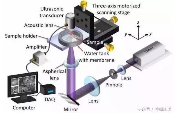 害怕乳腺癌切不净会复发？！新技术帮你杜绝复发风险！