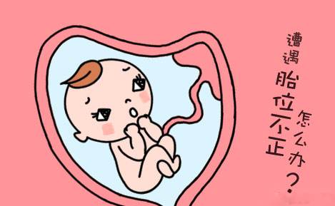 孕妈们注意这些姿势易胎位不正,孕妈臀位