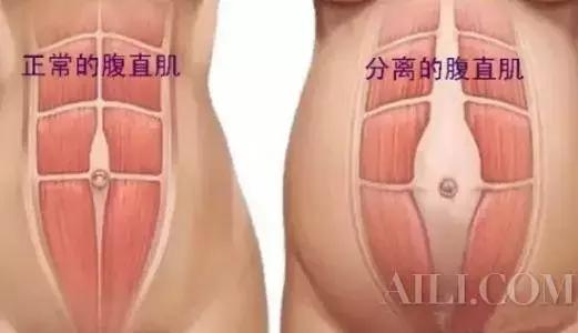 产后腰痛,都是麻醉惹的祸?事实上……