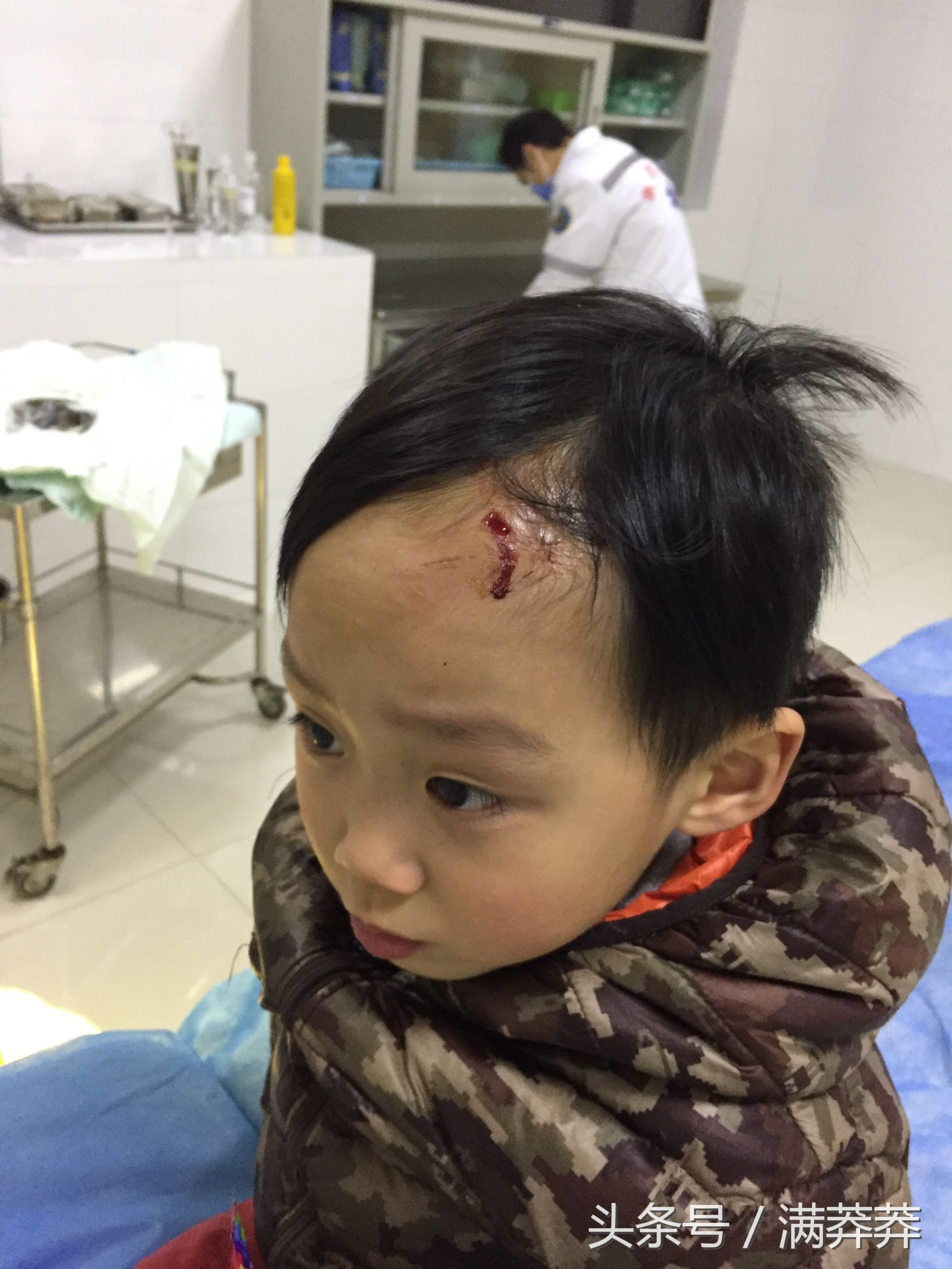 小孩额头摔破需要打破伤风针,可是破伤风抗毒素针测试过敏,为什么破伤风人体免疫球蛋白一针难求?