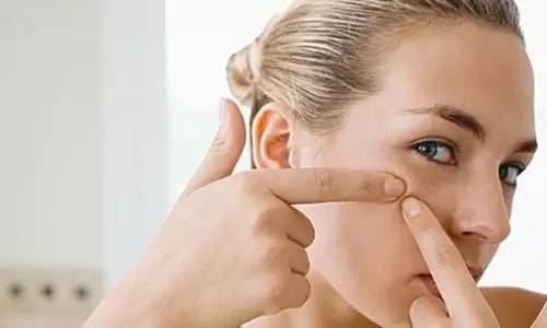 下巴长暗疮的原因,长暗疮用什么药膏