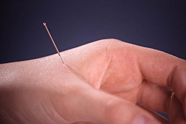 有什么简单的方法可以治头疼,头疼要重视