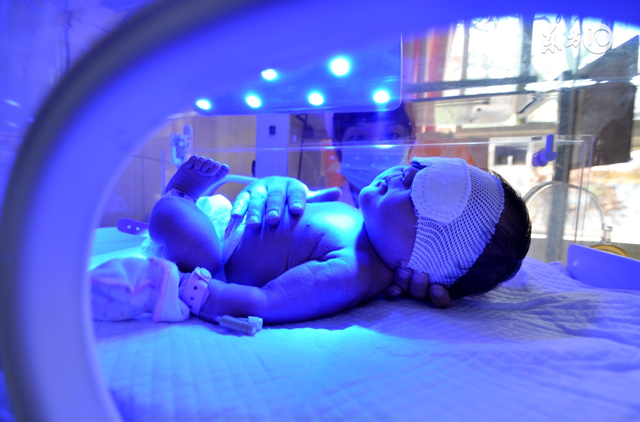 新生儿黄疸能吃能睡要紧吗,新生儿3天黄疸16要紧吗