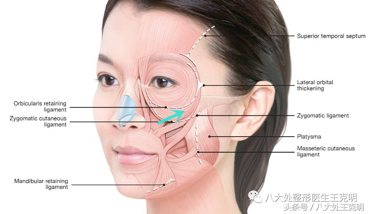杨紫的法令纹能消除吗,杨紫法令纹很深怎么回事