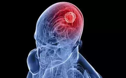 脑肿瘤手术后为什么会三叉神经疼,脑部肿瘤手术后头疼