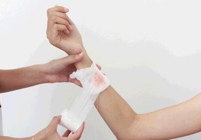 被狗狗咬了该怎么处理,被狗狗咬了要注意哪些事项