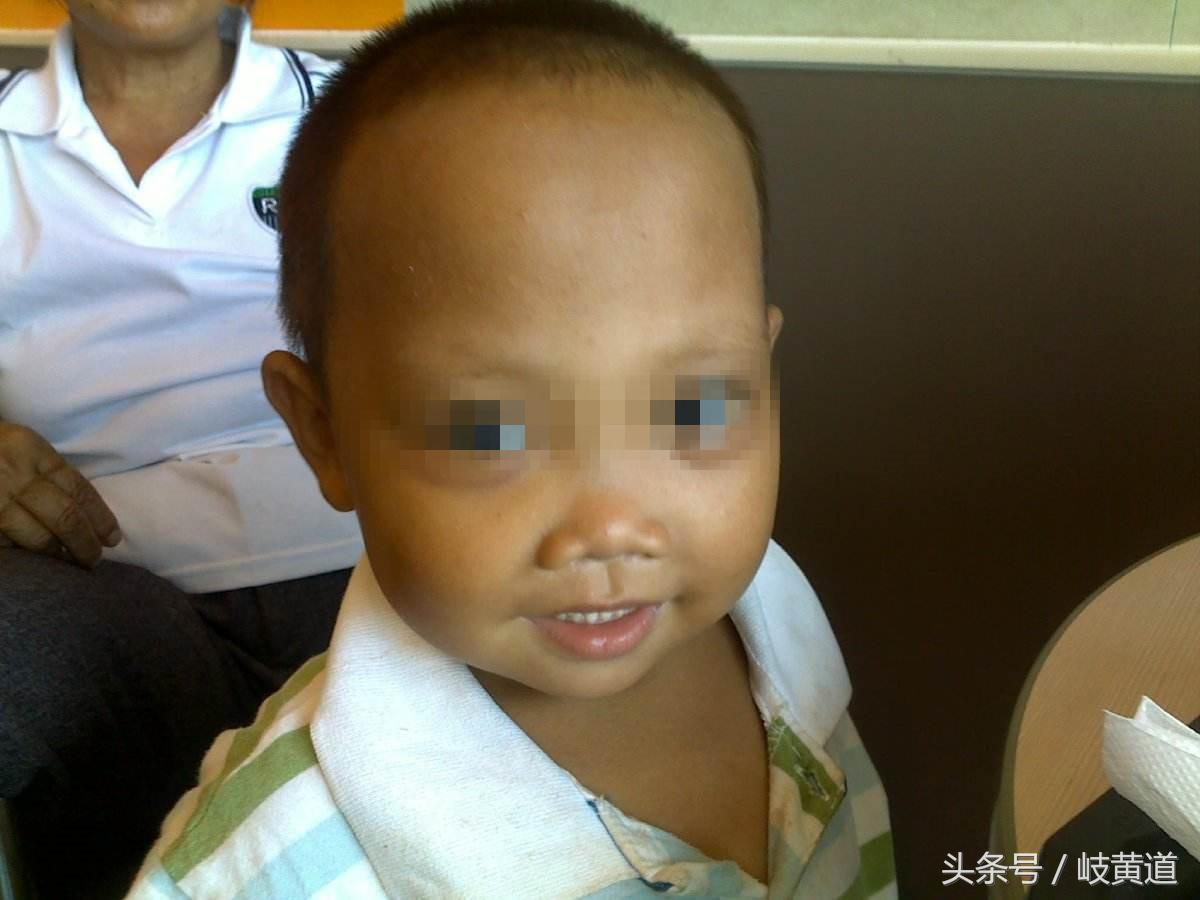 1岁半小孩贫血是什么原因造成的,儿童贫血一直都补不上去怎么办