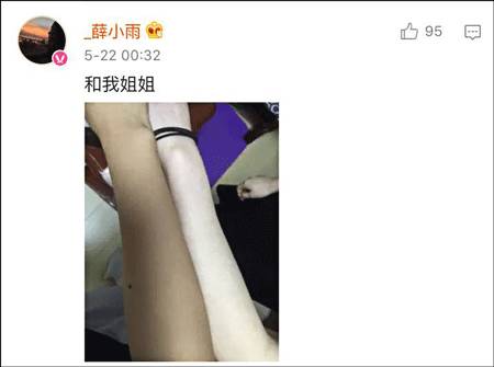 皮肤黑是一种什么感觉,脸很黑是什么体验