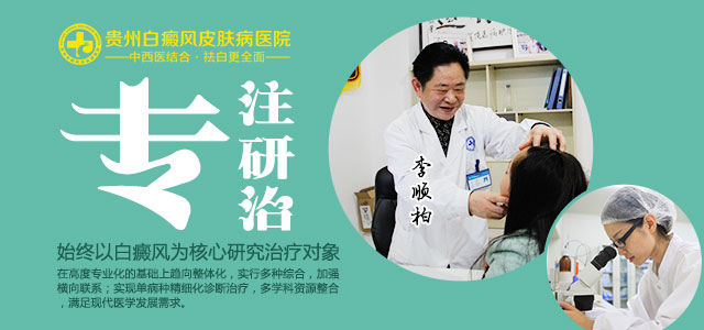 白癜风的四个初期症状,白癜风常见的20个问题