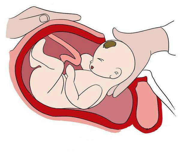 顺产和剖腹产到底哪个更好,一胎剖腹产二胎顺产三胎顺产快吗