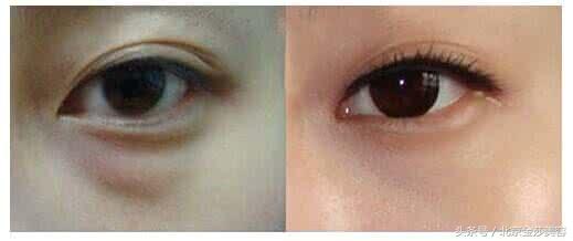 祛除黑眼圈眼袋的护肤品哪种好,什么眼霜祛除眼袋黑眼圈效果好