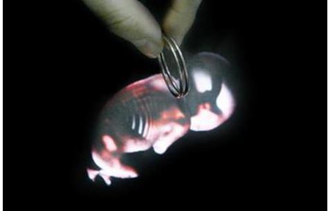 上环就是刮子宫吗,上环真的好吗