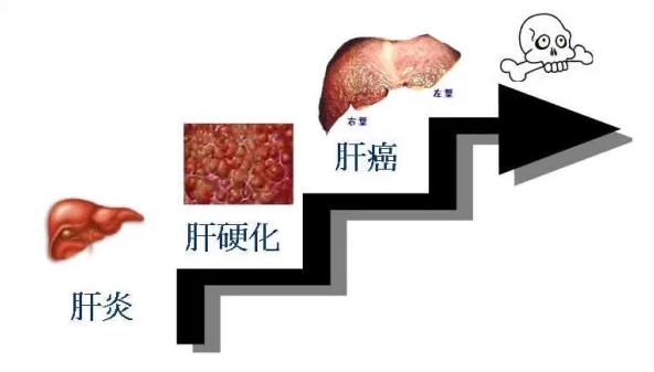 感冒手掌发黄是什么原因,手掌发红是肝炎吗