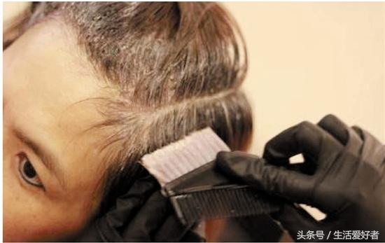 超有效的生发防脱发技巧,脱发怎么办四个有效生发方法