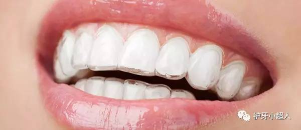 牙套材质钴镍哪个好,安牙套什么材质好