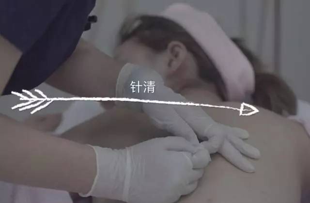 这可能是夏天穿吊带最大的烦恼……这可能是背部痘痘最全攻略