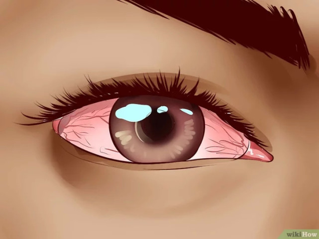 如何缓解眼睛干涩疼痛,怎么缓解眼睛疼痛痒