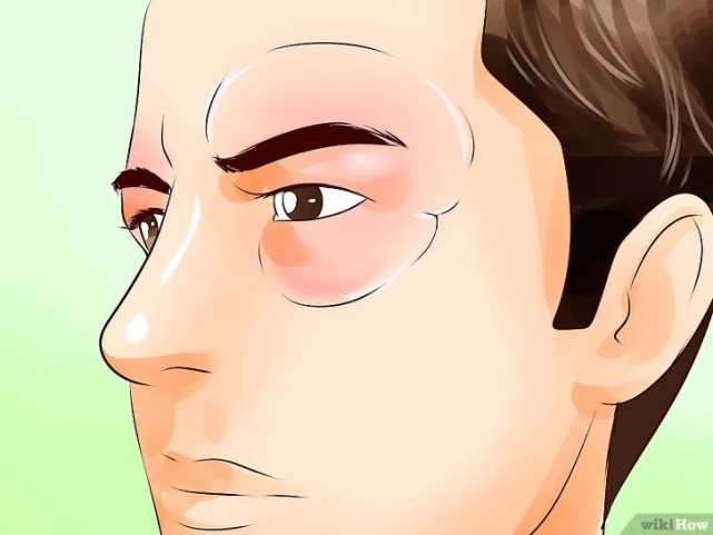 如何缓解眼睛干涩疼痛,怎么缓解眼睛疼痛痒