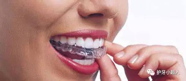 牙套材质钴镍哪个好,安牙套什么材质好