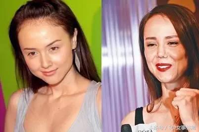 韩君婷厌食症,最美亚姐结局