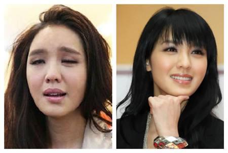 夏天吹风扇面瘫怎么办,电扇吹的面瘫怎么治