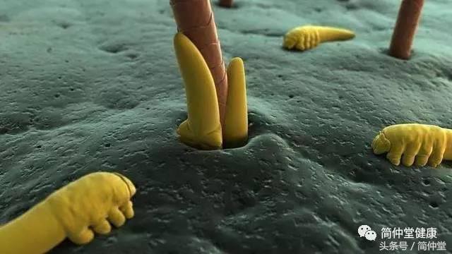 鼻翼两侧发红溃烂,鼻翼两侧发红是螨虫吗