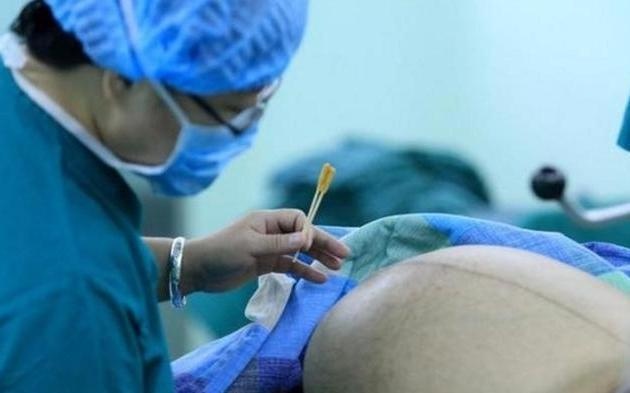 生孩子之前为什么要洗头发,生孩子需要除毛吗