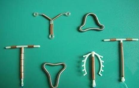 上环就是刮子宫吗,上环真的好吗