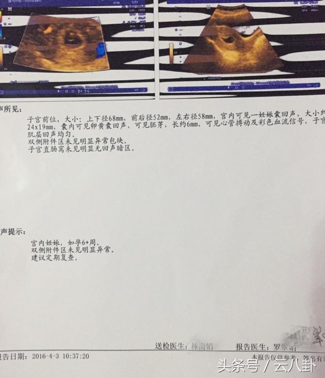 怀孕两个月身体一直流咖啡色东西，建档时医生说出一句话当场吓懵了