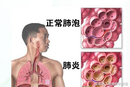 呼吸困难与气急气短区别,气短呼吸困难是什么原因