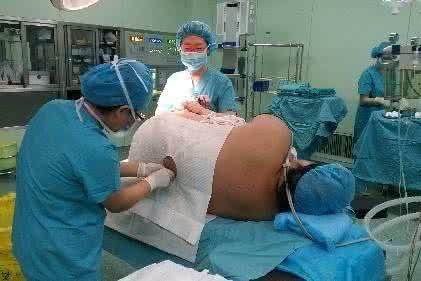 体重200斤的孕妇生孩子,医生说孩子像是在脂肪里抱出来的!