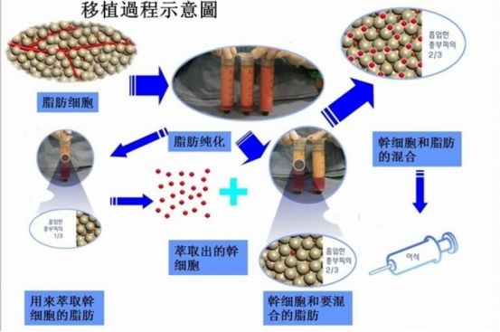 最先进治疗白癜风的方法,治疗白癜风三大方法