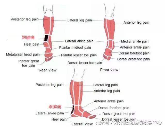 跟腱炎的治疗最好的方法,跟腱炎做什么运动恢复视频