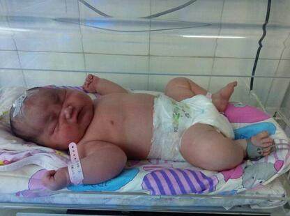 体重200斤的孕妇生孩子,医生说孩子像是在脂肪里抱出来的!