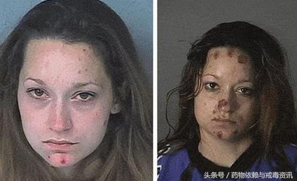 家人如何帮助吸毒者戒毒,如果发现家人吸毒怎么办