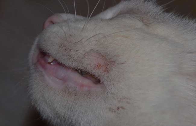 铲屎官得猫癣症状,铲屎官感染猫癣用什么药