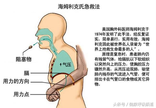 呼吸困难与气急气短区别,气短呼吸困难是什么原因